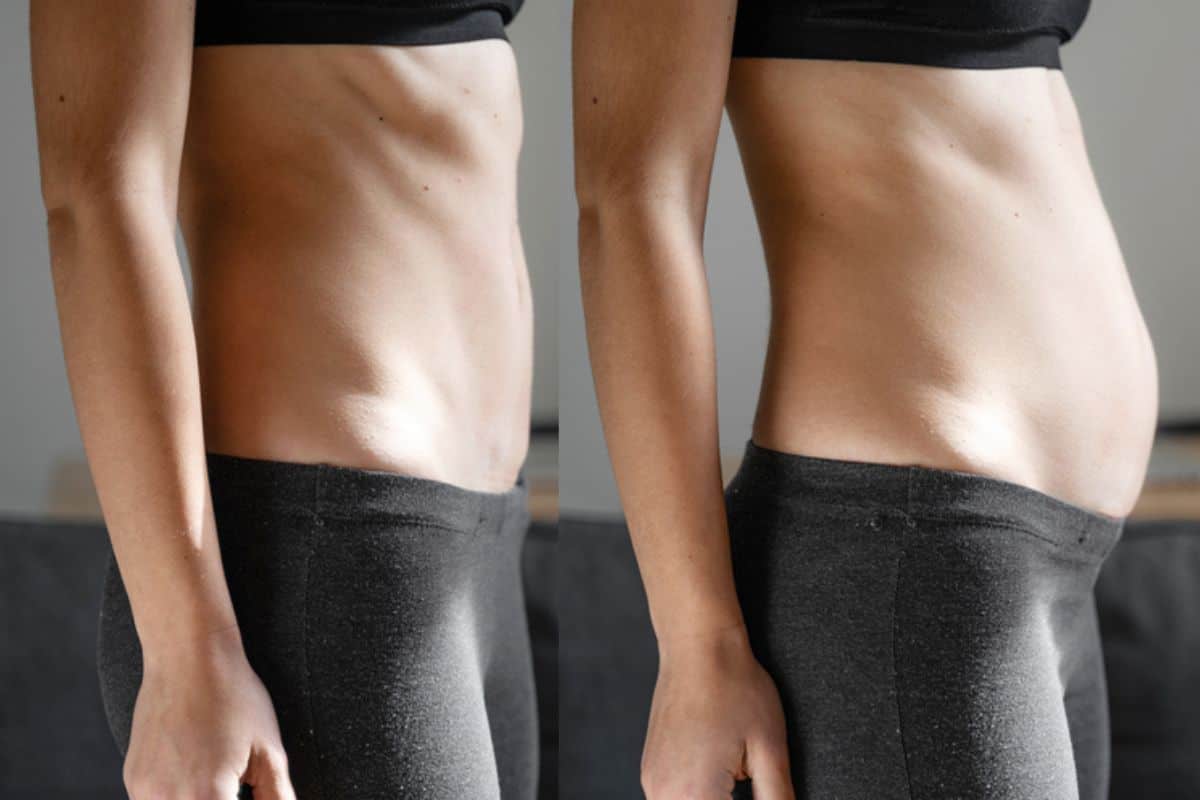 How long does diastasis recti take to improve Smethwick?