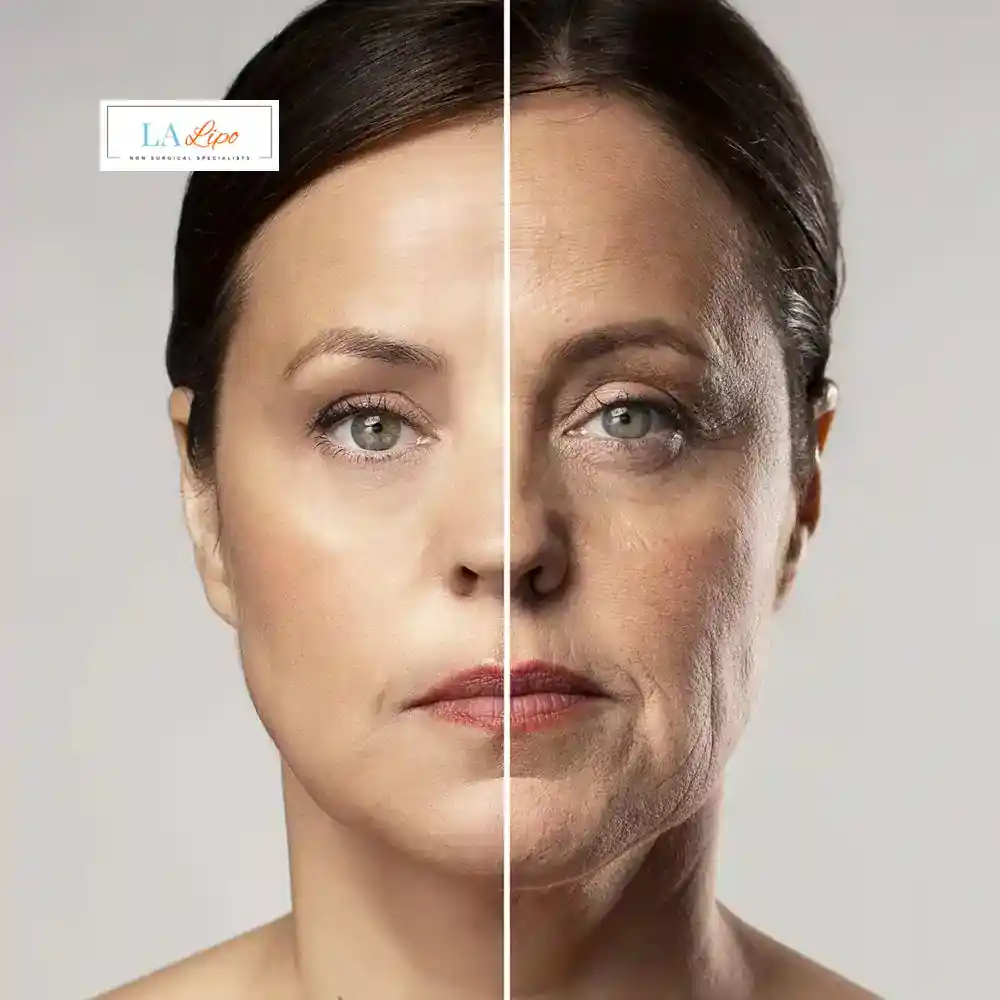 How Can You Tell If Non-Surgical Skin Tightening Is Right for You Smethwick?